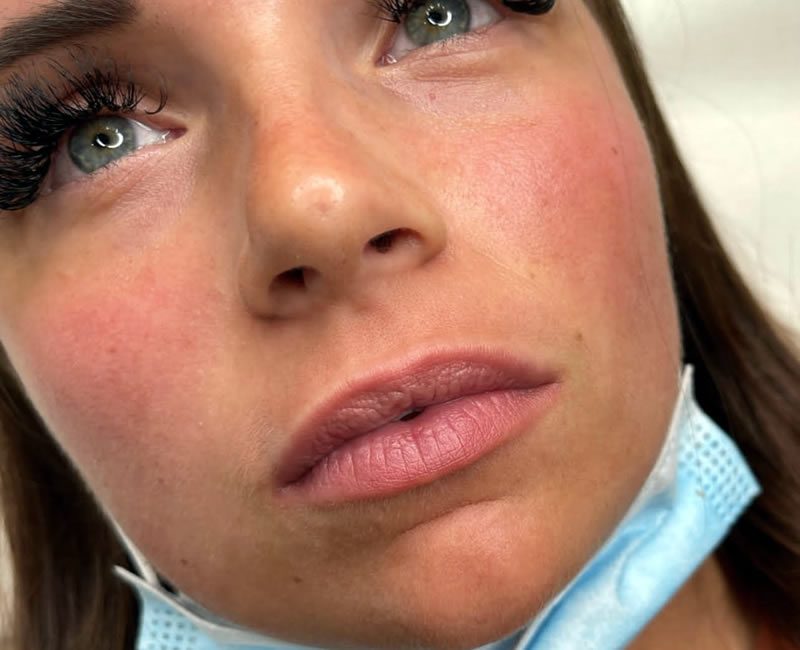Signature lips - before