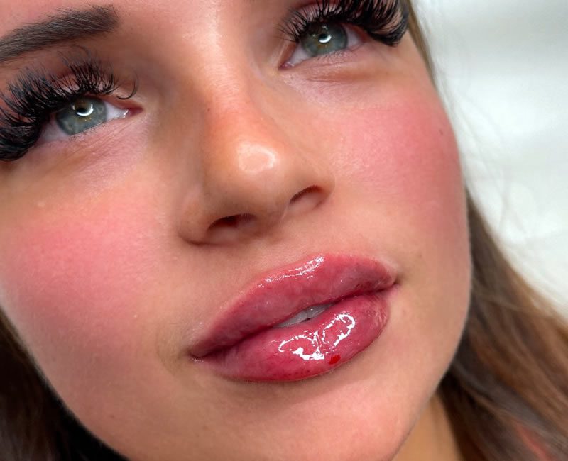 Signature lips - after